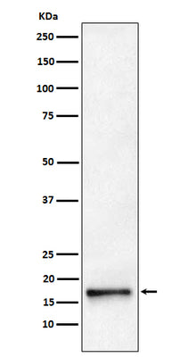 Anti-AP2S1 Rabbit Monoclonal Antibody Boster Bio