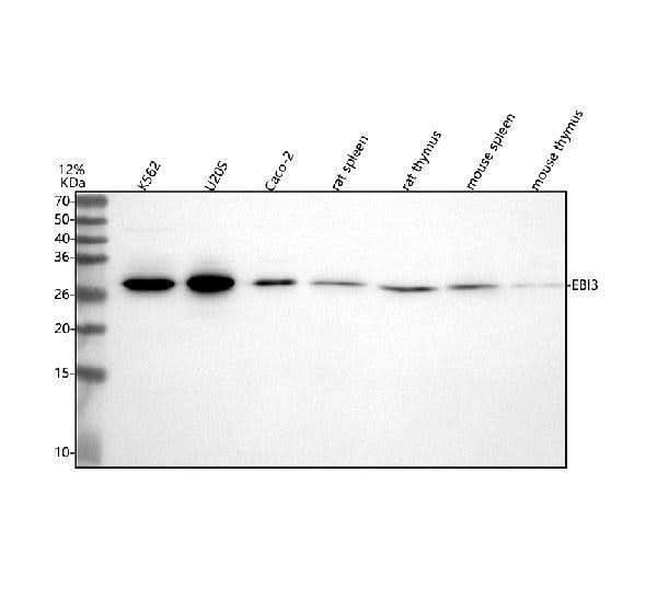 Anti-EBI3 Rabbit Monoclonal Antibody Boster Bio