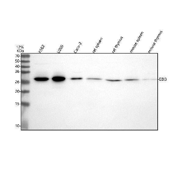 Anti-EBI3 Rabbit Monoclonal Antibody Boster Bio