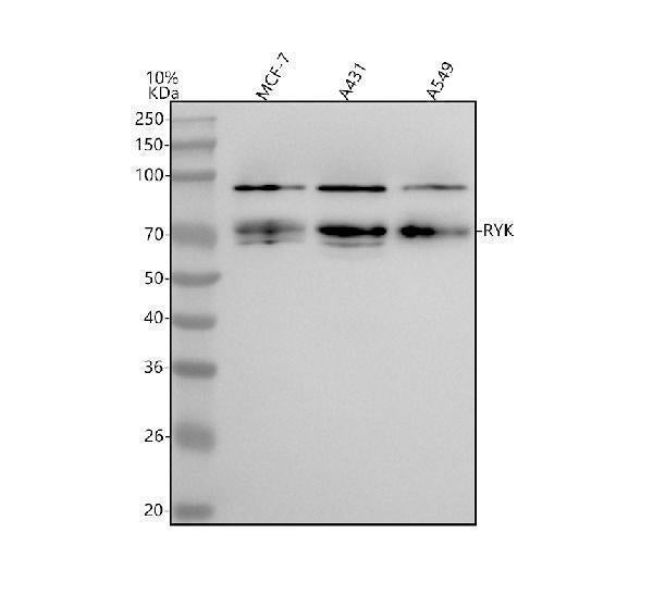 Anti-RYK Rabbit Monoclonal Antibody Boster Bio