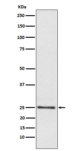 Anti-Lysophospholipase 1 Rabbit Monoclonal Antibody Boster Bio