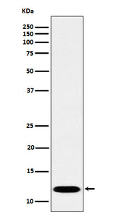 Anti-PCBD1 Rabbit Monoclonal Antibody Boster Bio