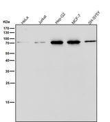 Anti-ERp72 Rabbit Monoclonal Antibody Boster Bio