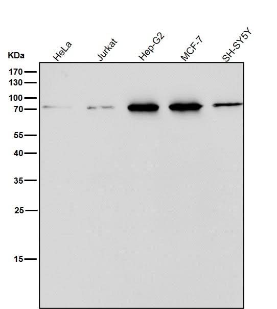 Anti-ERp72 Rabbit Monoclonal Antibody Boster Bio