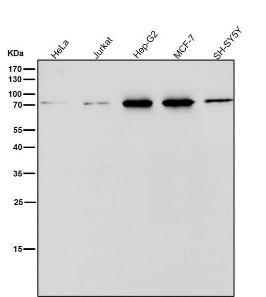Anti-ERp72 Rabbit Monoclonal Antibody Boster Bio