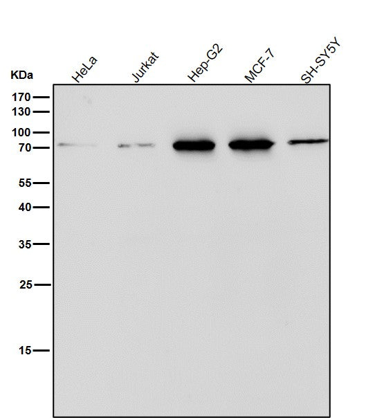Anti-ERp72 Rabbit Monoclonal Antibody Boster Bio