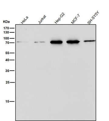 Anti-ERp72 Rabbit Monoclonal Antibody Boster Bio