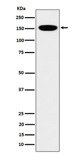 Anti-CNAP1 Rabbit Monoclonal Antibody Boster Bio