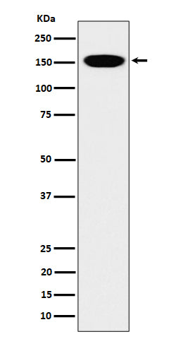 Anti-CNAP1 Rabbit Monoclonal Antibody Boster Bio