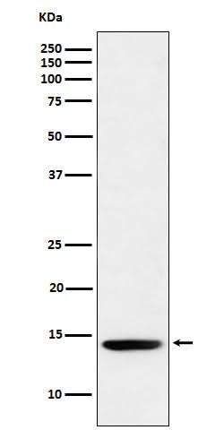 Anti-Histone H2B (formyl K120) Rabbit Monoclonal Antibody Boster Bio
