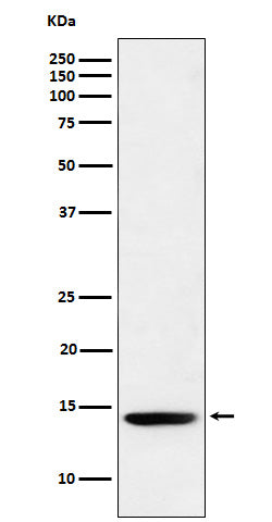 Anti-Histone H2B (formyl K120) Rabbit Monoclonal Antibody Boster Bio
