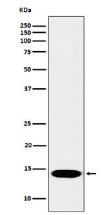 Anti-Histone H2B (mono methyl K116) Rabbit Monoclonal Antibody Boster Bio