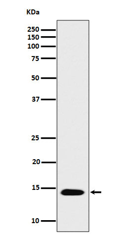 Anti-Histone H2B (acetyl K16) Rabbit Monoclonal Antibody Boster Bio