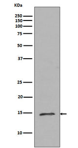 Anti-Histone H2B (mono methyl R79) HIST2H2BE Rabbit Monoclonal Antibody Boster Bio