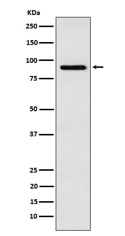 Anti-RSK4 Rabbit Monoclonal Antibody Boster Bio