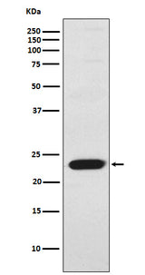 Anti-TNNI2 Rabbit Monoclonal Antibody Boster Bio