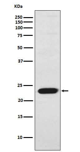 Anti-TNNI2 Rabbit Monoclonal Antibody Boster Bio