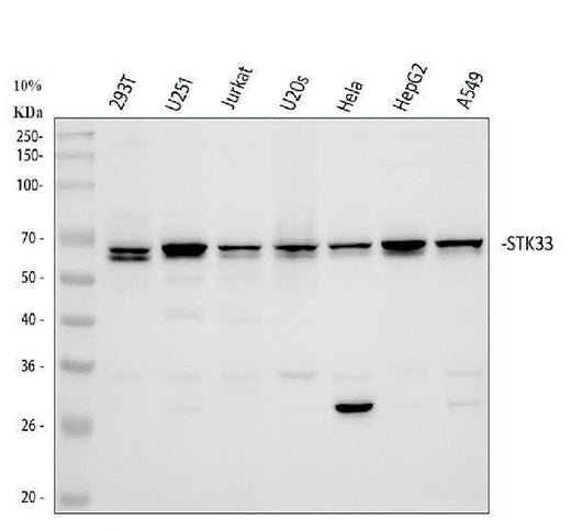 Anti-STK33 Rabbit Monoclonal Antibody Boster Bio