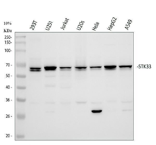 Anti-STK33 Rabbit Monoclonal Antibody Boster Bio