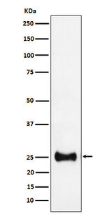 Anti-Adenylate kinase 4 Rabbit Monoclonal Antibody Boster Bio