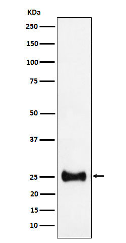 Anti-Adenylate kinase 4 Rabbit Monoclonal Antibody Boster Bio