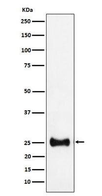 Anti-Adenylate kinase 4 Rabbit Monoclonal Antibody Boster Bio