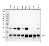 Anti-NOP10 Rabbit Monoclonal Antibody Boster Bio