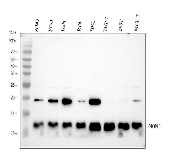 Anti-NOP10 Rabbit Monoclonal Antibody Boster Bio