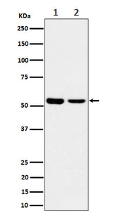 Anti-AAMP Rabbit Monoclonal Antibody Boster Bio