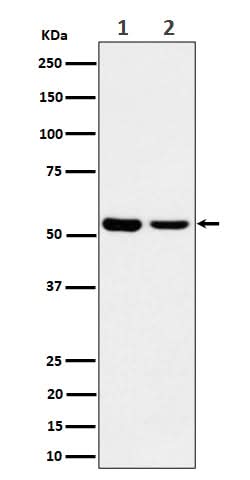 Anti-AAMP Rabbit Monoclonal Antibody Boster Bio