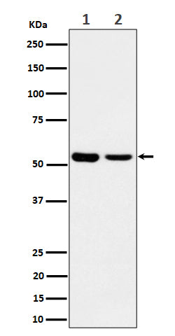 Anti-AAMP Rabbit Monoclonal Antibody Boster Bio