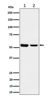 Anti-AAMP Rabbit Monoclonal Antibody Boster Bio