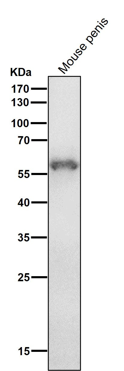 Anti-Cytokeratin 4 KRT4 Rabbit Monoclonal Antibody Boster Bio