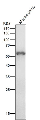 Anti-Cytokeratin 4 KRT4 Rabbit Monoclonal Antibody Boster Bio