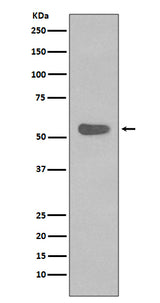 Anti-Cytokeratin 4 KRT4 Rabbit Monoclonal Antibody Boster Bio