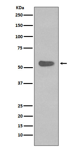 Anti-Cytokeratin 4 KRT4 Rabbit Monoclonal Antibody Boster Bio