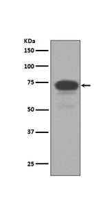 Anti-5T4 TPBG Rabbit Monoclonal Antibody Boster Bio