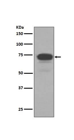Anti-5T4 TPBG Rabbit Monoclonal Antibody Boster Bio