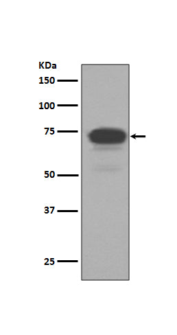 Anti-5T4 TPBG Rabbit Monoclonal Antibody Boster Bio