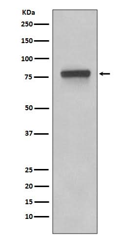 Anti-5T4 TPBG Rabbit Monoclonal Antibody Boster Bio