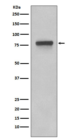 Anti-5T4 TPBG Rabbit Monoclonal Antibody Boster Bio