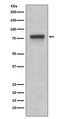 Anti-5T4 TPBG Rabbit Monoclonal Antibody Boster Bio