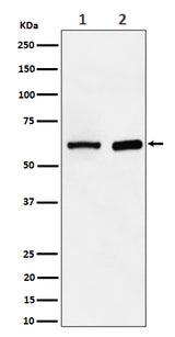 Anti-ATE1 Rabbit Monoclonal Antibody Boster Bio