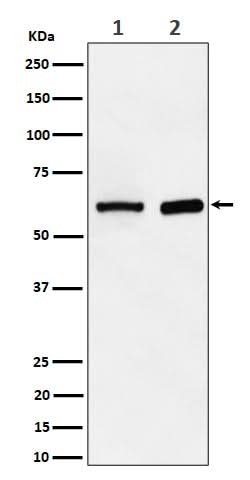 Anti-ATE1 Rabbit Monoclonal Antibody Boster Bio