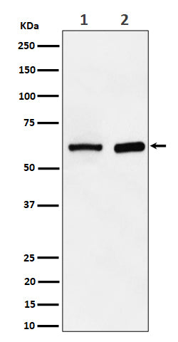 Anti-ATE1 Rabbit Monoclonal Antibody Boster Bio