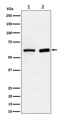 Anti-ATE1 Rabbit Monoclonal Antibody Boster Bio