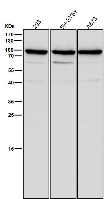 Anti-SCIN Rabbit Monoclonal Antibody Boster Bio