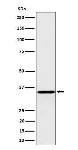 Anti-Pyrophosphatase 1 Rabbit Monoclonal Antibody Boster Bio
