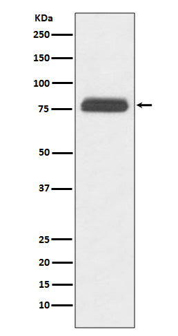 Anti-TBR1 Rabbit Monoclonal Antibody Boster Bio