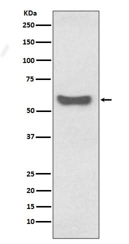 Anti-IgA Rabbit Monoclonal Antibody Boster Bio